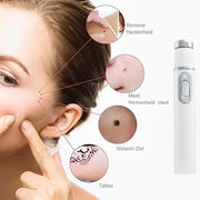 Medical Grade Laser Pen Remove Scars, Spots, Veins & Tattoos Safely at Home