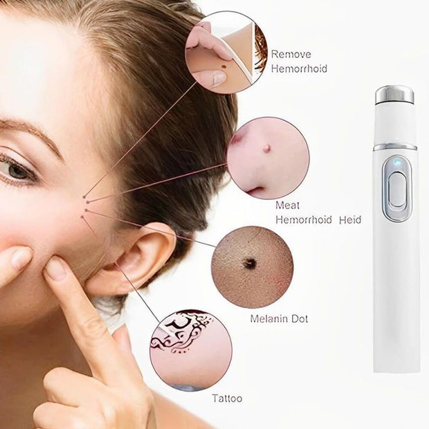 Medical Grade Laser Pen Remove Scars, Spots, Veins & Tattoos Safely at Home