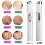 Medical Grade Laser Pen Remove Scars, Spots, Veins & Tattoos Safely at Home
