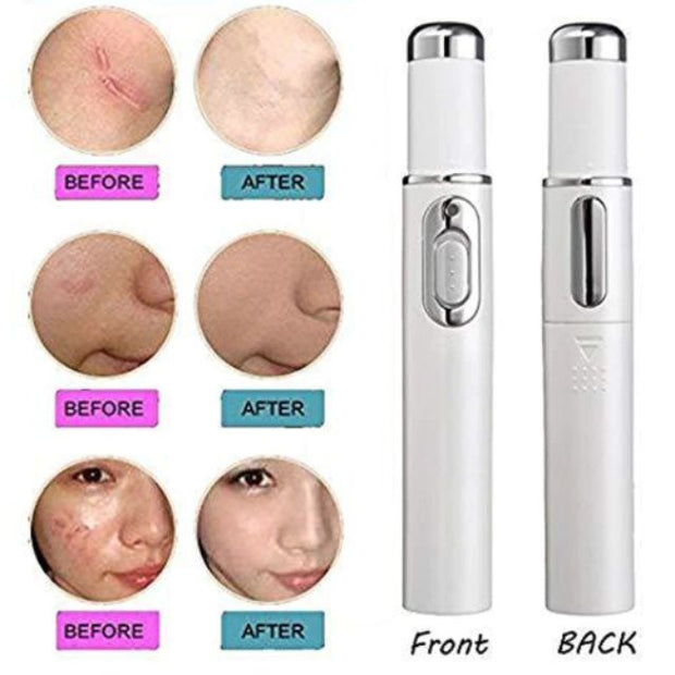 Medical Grade Laser Pen Remove Scars, Spots, Veins & Tattoos Safely at Home