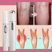 Medical Grade Laser Pen Remove Scars, Spots, Veins & Tattoos Safely at Home