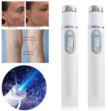 Laser therapy pen for removing dark spots, veins, and tattoos