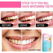 Niacinamide Whitening Toothpaste, Instant Teeth Brightening Formula