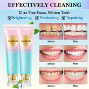 Niacinamide Whitening Toothpaste, Instant Teeth Brightening Formula